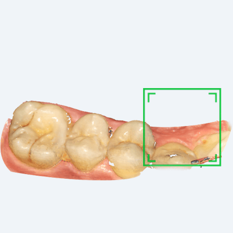 Shining 3D Aoralscan 2