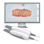 Shining 3D Aoralscan 2