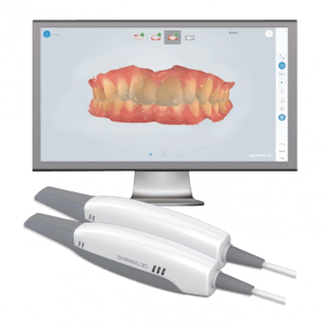 Shining 3D Aoralscan 2