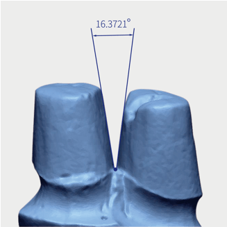 shining 3d autoscan ds ex pro 3d scanner